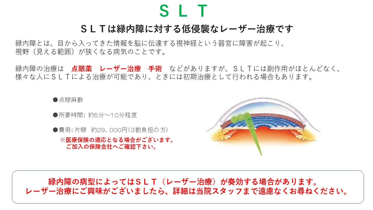 SLT-YAGレーザーの詳細